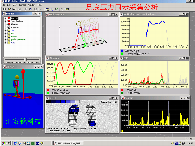 研究步态和脚底压力及肌电.bmp